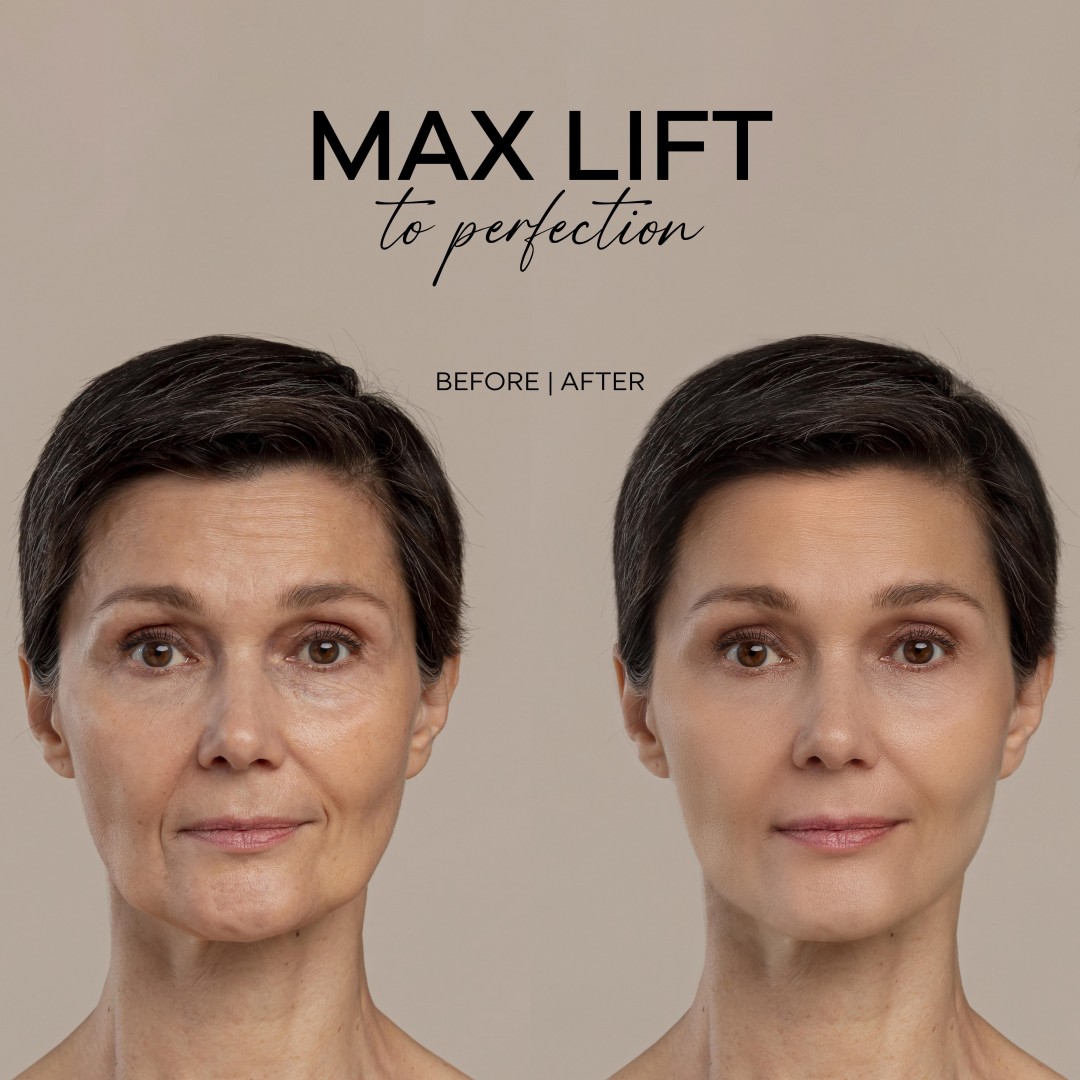 FX Max Lift to Perfection Cream 15 ml